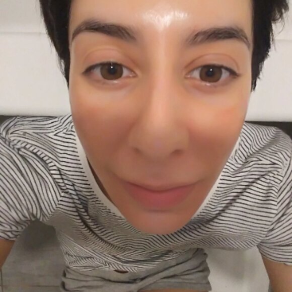 Vegan Lactic Acid peel 50% Melasma Hyperpigmentation Acne Scars Anti Aging etc - Picture 2 of 12